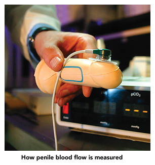 penile blood flow measurments